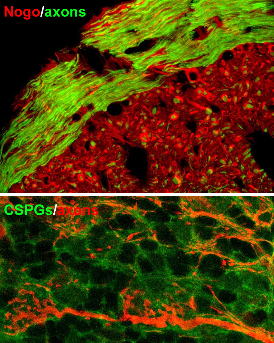 Fig. 1. Molecole inibitrici la crescita neuritica nel SNC adulto. Il pannello superiore mostra la distribuzione di Nogo-A negli oligodendrociti maturi (in rosso, in verde sono marcati gli assoni); in quello inferiore si può apprezzare la matrice formata dai CSPG (in verde) intorno agli assoni ed alle terminazioni (in rosso).